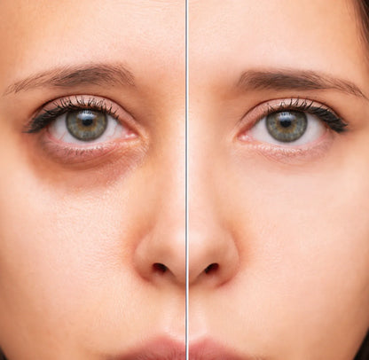 Duo Antiojeras Blue — Parches de hidrogel + contorno de ojos